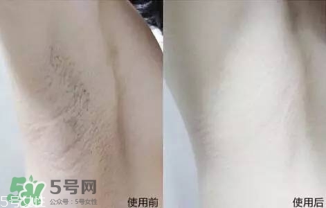 nair脫毛膏評測？nair脫毛膏保質(zhì)期