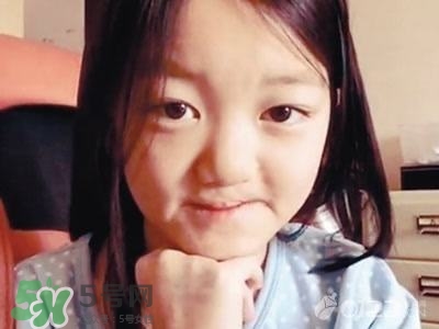 兔唇是什么？兔唇是什么原因造成的？