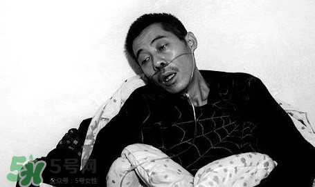 塵肺病吃什么藥能清肺？塵肺病國家有什么政策