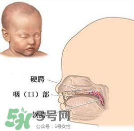 兔唇能檢查出來嗎？兔唇能完全修復嗎？
