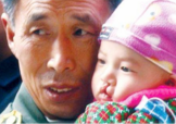 兔唇是什么？兔唇是什么原因造成的？