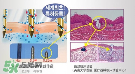 珠兒麗蚊子針好用嗎？珠兒麗蚊子針副作用