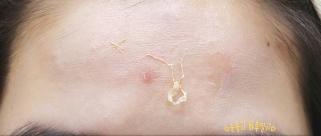 real skin patch怎么樣？real skin是什么牌子