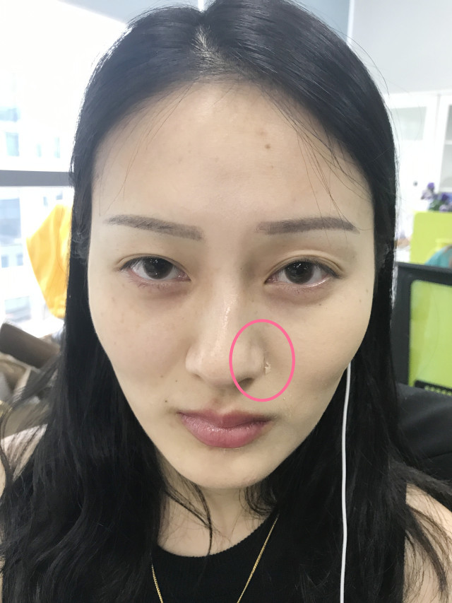 real skin patch怎么樣？real skin是什么牌子