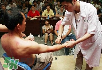 刮痧痛嗎？刮痧疼還是拔罐疼