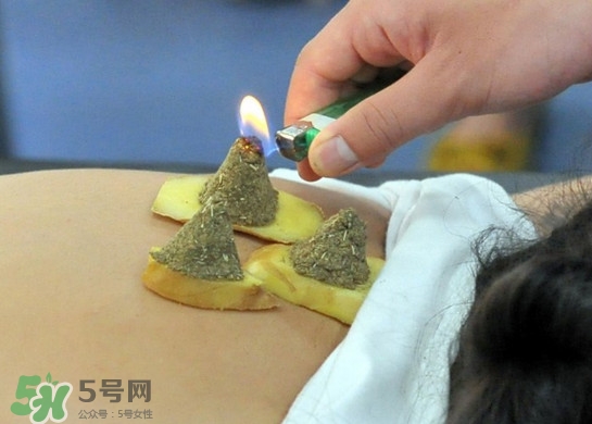 三伏灸有用嗎？2017年三伏艾灸時(shí)間