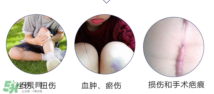 hirudoid除疤膏有效嗎？hirudoid去疤膏效果如何？