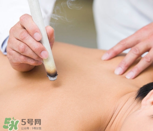 三伏貼和艾灸哪個(gè)好？三伏貼和艾灸區(qū)別