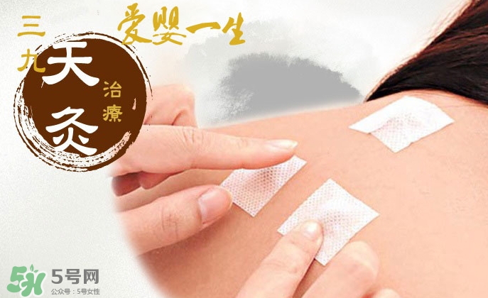 貼三伏貼掛什么科？三伏貼掛什么號(hào)？