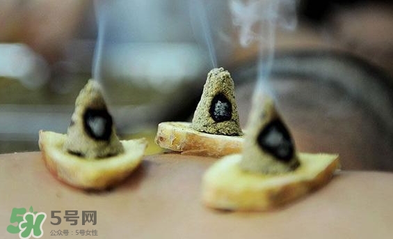 貼三伏貼可以艾灸嗎？貼三伏貼多久可以艾灸