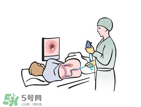 直腸癌怎么查出來的？直腸癌怎么判斷早晚期