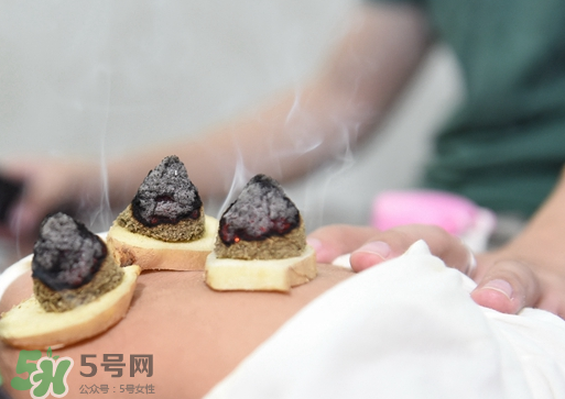 三伏灸什么人不能做？三伏灸適合哪些人？