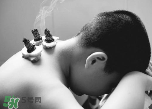 三伏灸什么人不能做？三伏灸適合哪些人？