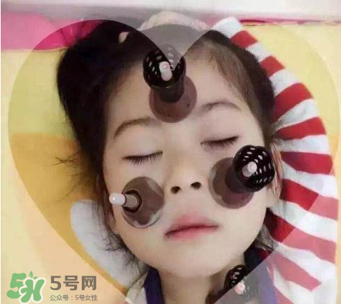 艾灸貼可以治咳嗽嗎？艾灸貼可以治退燒嗎？