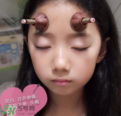 艾灸貼可以治咳嗽嗎？艾灸貼可以治退燒嗎？