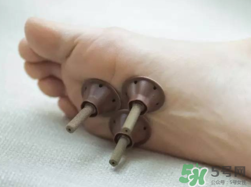 艾艾貼灸出水珠為什么？艾艾貼后有水珠要擦嗎？