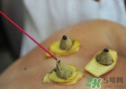 三伏灸可以自己灸嗎？三伏灸可以在家做嗎？