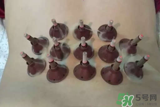 艾艾貼可以貼肚臍眼嗎？艾艾貼貼肚臍有什么作用？