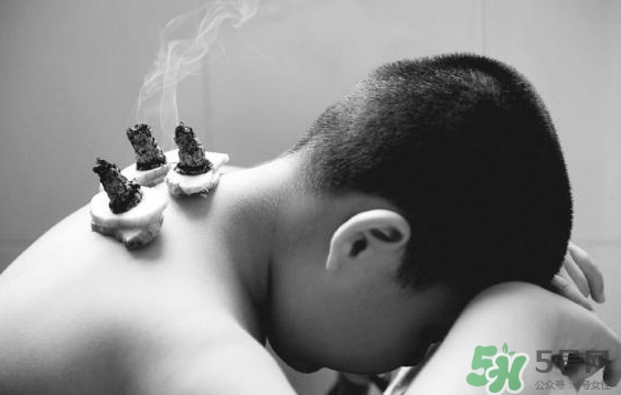 三伏灸要灸幾次？三伏灸要灸多久？