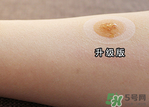 艾灸貼后有水泡怎么辦？貼艾灸貼應(yīng)注意些什么？