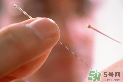 針灸可以治療失眠嗎？失眠時(shí)針灸哪些穴位有效