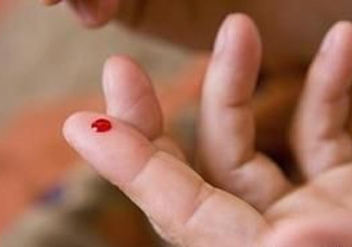 放血療法能治濕氣重嗎？放血療法治病的原理是什么
