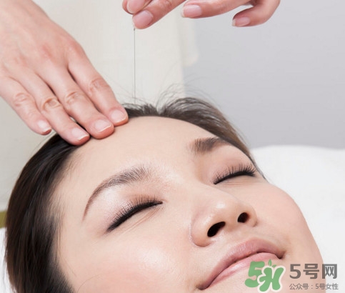 針灸到底疼不疼啊？針灸最適合哪些病