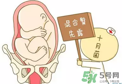 胎位不正能順產(chǎn)嗎？胎位不正怎么辦？