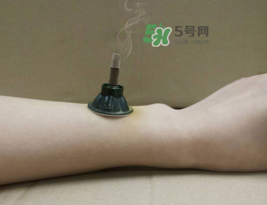 三伏天下雨可以艾灸嗎？三伏天下雨艾灸好嗎？