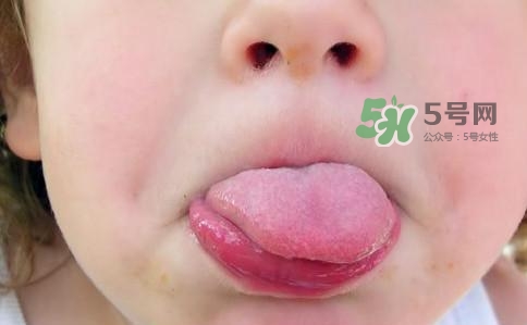 三伏天為什么濕氣重？三伏天為什么要注意祛濕？