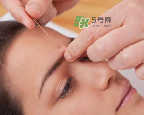 三伏天針灸有什么好處？三伏天針灸注意什么？