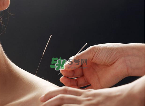 三伏天針灸有什么好處？三伏天針灸注意什么？