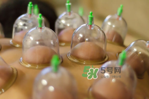 拔火罐是夏天好還是冬天好？什么時候拔火罐最合適？