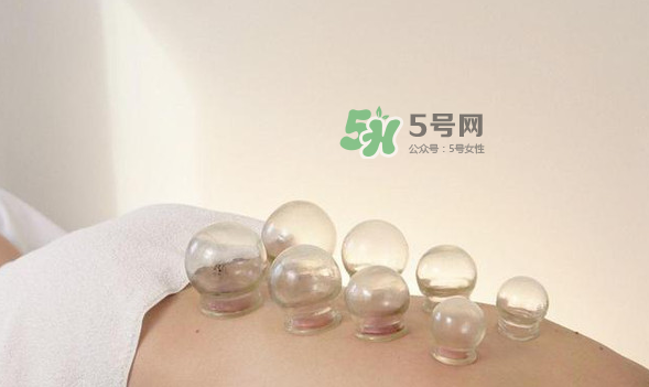拔火罐是夏天好還是冬天好？什么時候拔火罐最合適？
