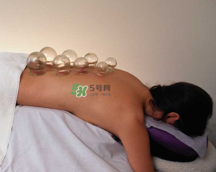 拔火罐一次多長時(shí)間？拔火罐一般多長時(shí)間？