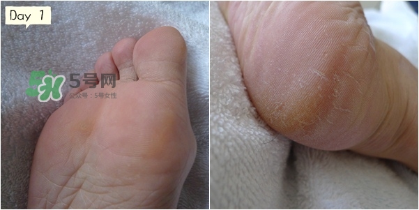 baby foot足膜怎么用？baby foot足膜使用方法