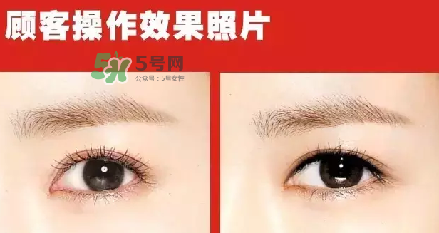 美瞳線有必要做嗎？做美瞳線多少錢？
