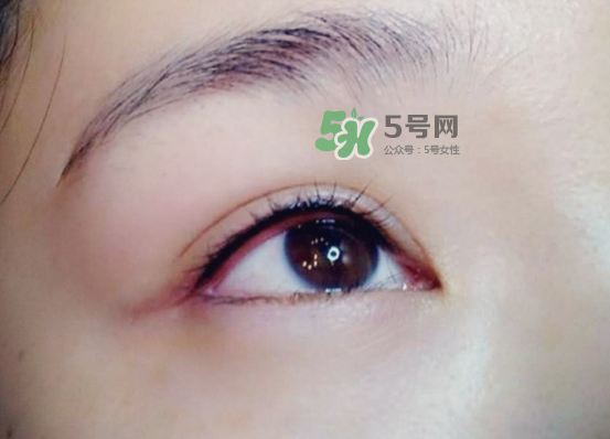 做美瞳線疼嗎？做美瞳線后要注意什么？