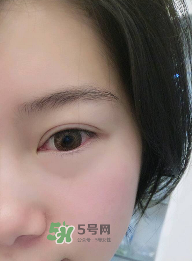 做美瞳線疼嗎？做美瞳線后要注意什么？