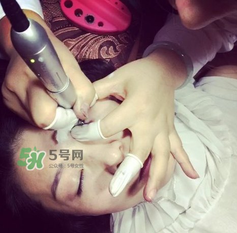 做美瞳線要打麻藥嗎？做美瞳線麻藥怎么敷？