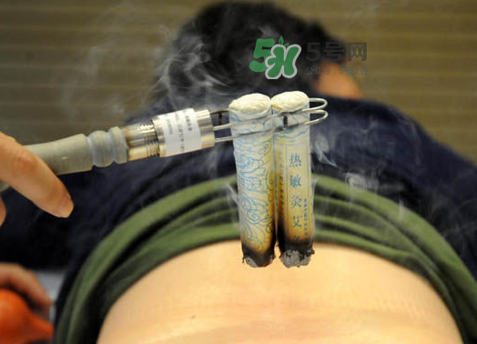 三伏天艾灸后能吹空調(diào)嗎？三伏天艾灸后能吹電扇嗎？