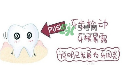 牙齒松動會自己好嗎？牙齒松動會自己掉嗎