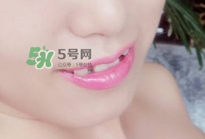 牙齒縫隙大怎么辦？牙縫大帶牙套有用嗎