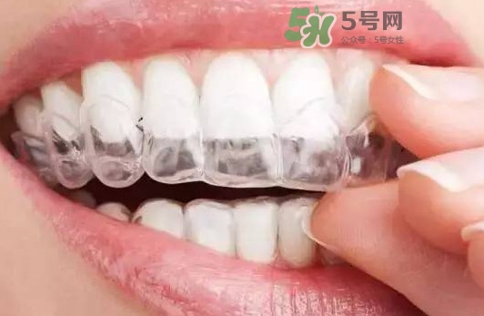 牙齒有縫隙可以補(bǔ)嗎？牙齒縫隙大能補(bǔ)嗎
