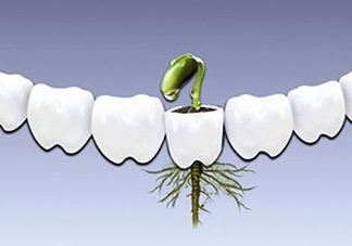 種植牙多少錢一顆？為什么種植牙很貴