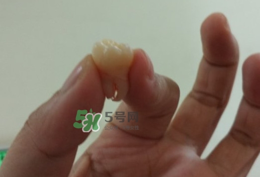 拔智齒痛嗎？智齒拔了多久洞會(huì)好？