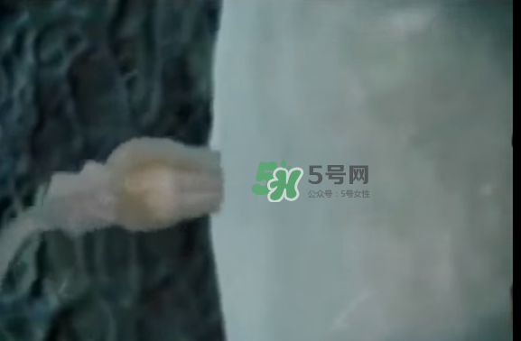 懷孕初期怎么保胎？陰道出血是流產(chǎn)征兆嗎？