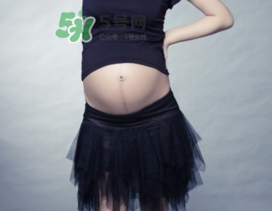 頭胎有妊娠線二胎沒有是因?yàn)閷殞毿詣e不一樣嗎？