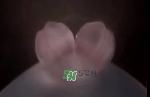 懷孕初期怎么保胎？陰道出血是流產(chǎn)征兆嗎？