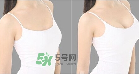 女性乳頭癢是怎么回事？女性乳頭癢要怎么治療？